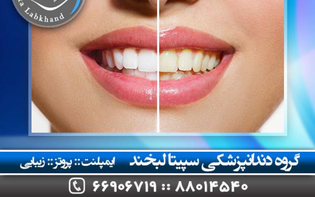 دندانپزشکی سپیتالبخند - تهران